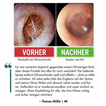 Religenix® Haftender Ohrreinigungs-Stick
