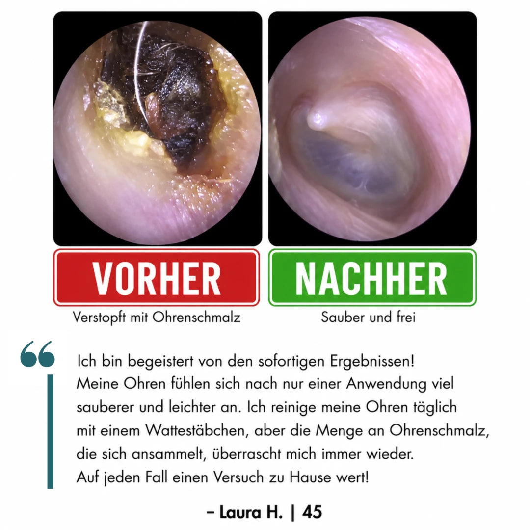 Religenix® Haftender Ohrreinigungs-Stick