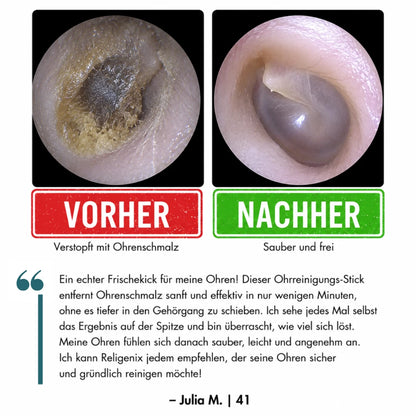 Religenix® Haftender Ohrreinigungs-Stick